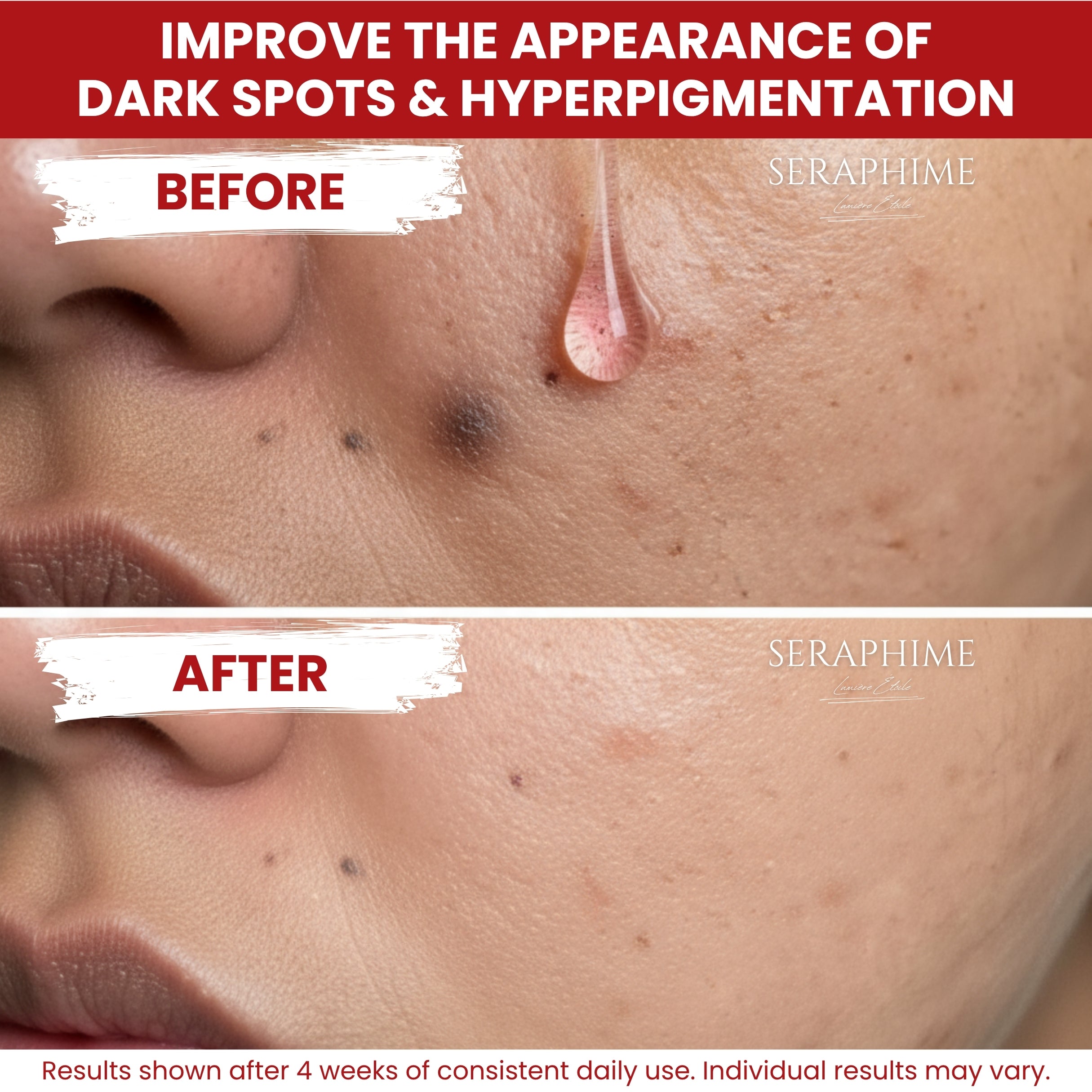 Tranexamic Acid TXA 4% + Niacinamide 10% Serum