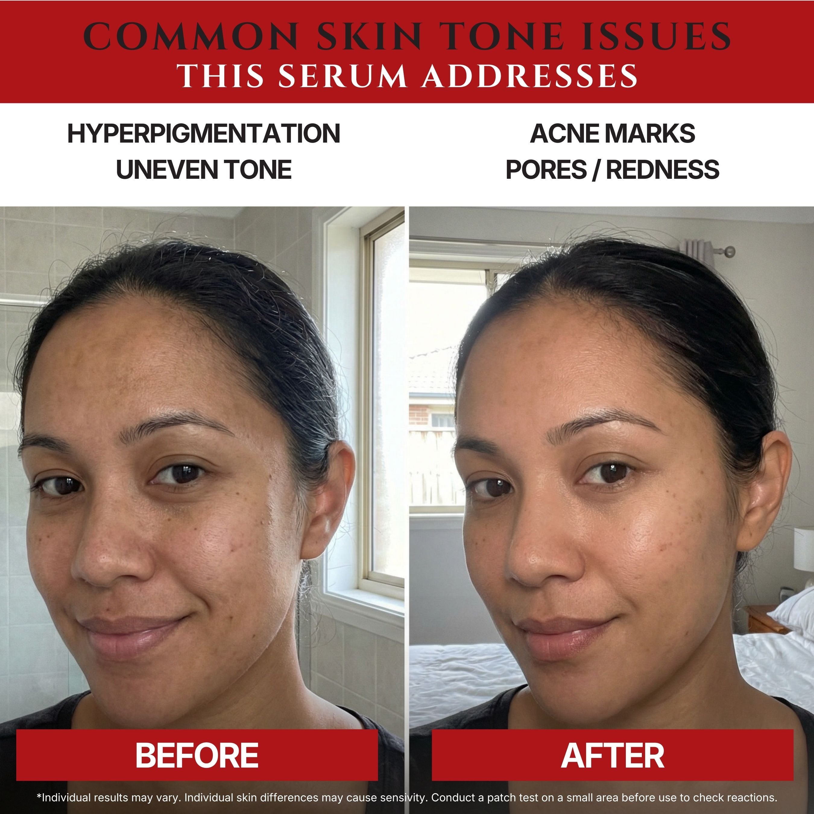 Tranexamic Acid TXA 4% & Niacinamide 10% Serum