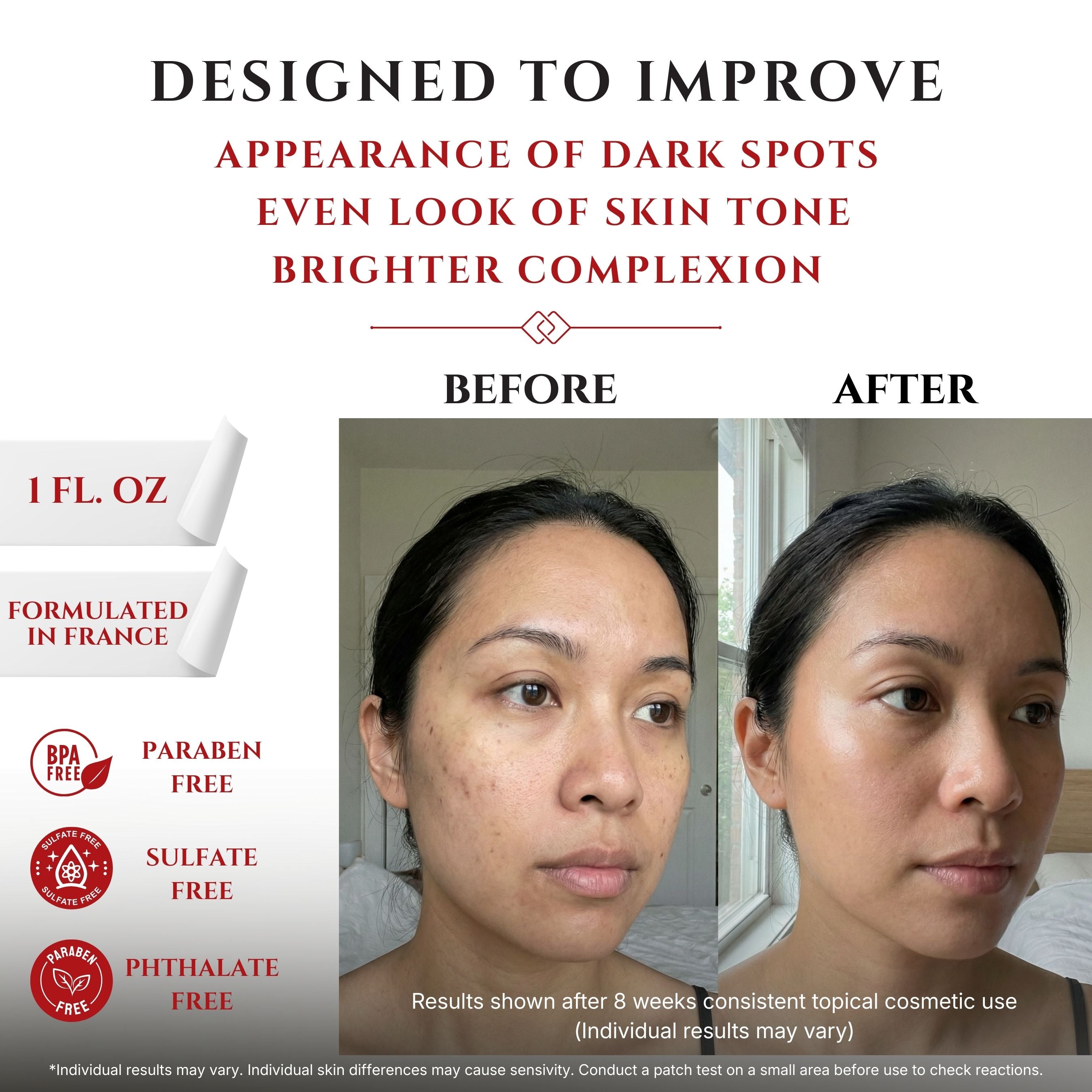 Tranexamic Acid TXA 4% & Niacinamide 10% Serum