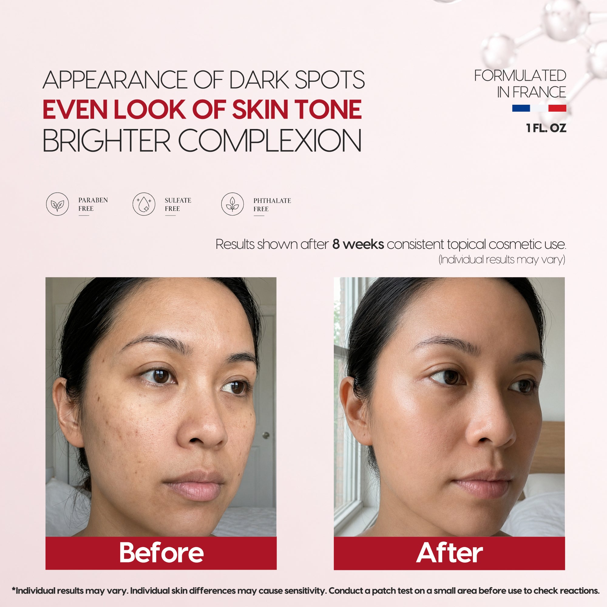 Tranexamic Acid TXA 4% & Niacinamide 10% Serum