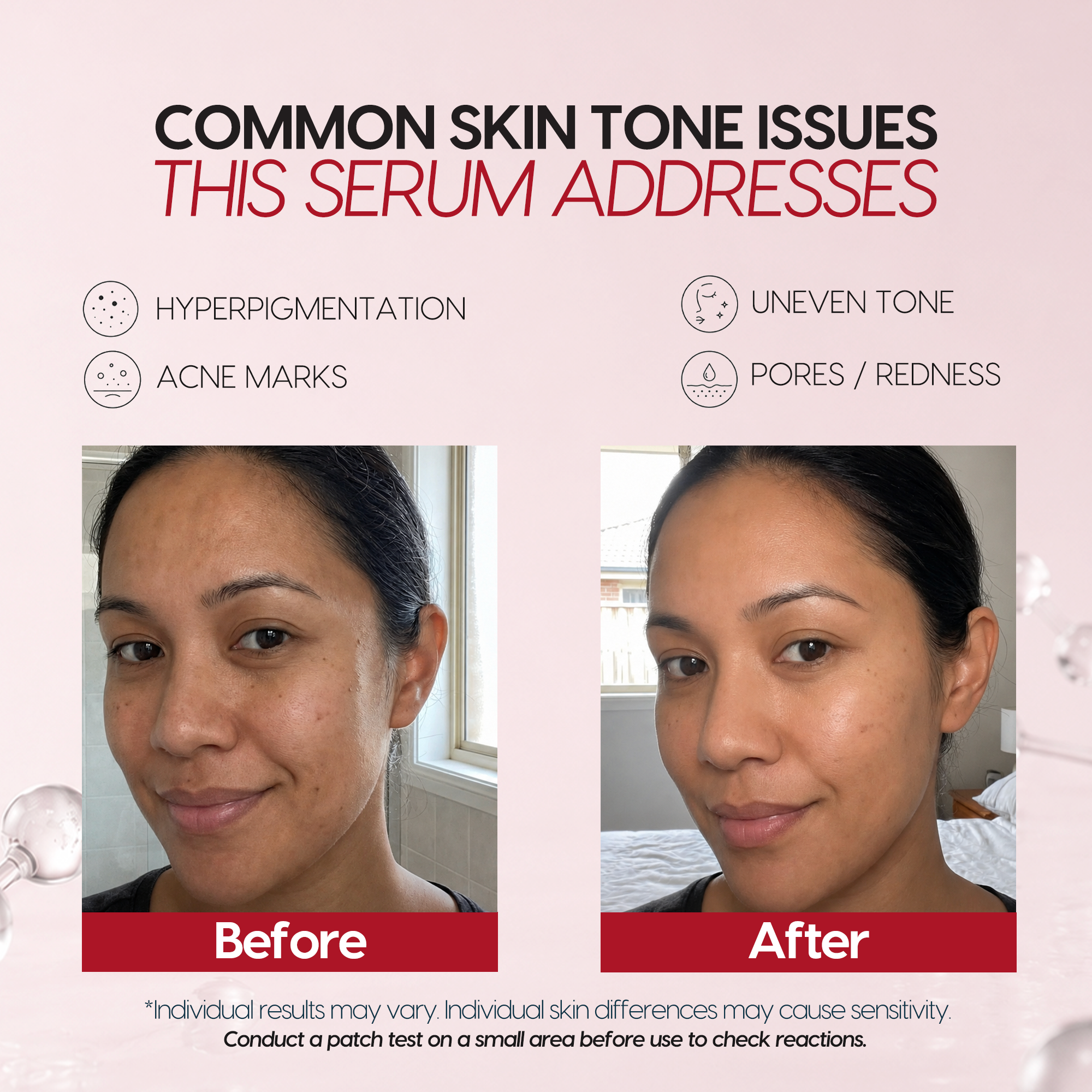 Tranexamic Acid TXA 4% & Niacinamide 10% Serum